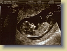 Week12-Ultrasound-01Aug2011 (5) * 3086 x 2316 * (5.04MB)